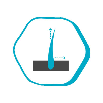 j7 j7 Efter hårtransplantation Istanbul Hair DK Prices in Turkey